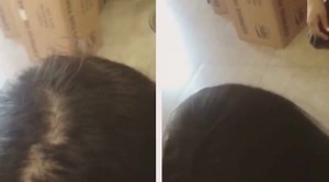 Another amazing before and after! Hair Cubed microfiber spray has results so great they speak for themselves! Try with a 30 day money back guarantee by visiting www.haircubed.com today! #haircubed #hairloss #results #microfiber #beforeandafter #baldspot #thinhair #hair #hairproduct @haircubed | Hair Cubed Patented,#1 Solution For Thin & Fine Hair