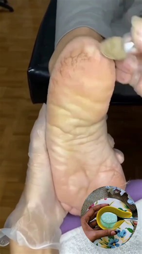 Dirty Feet Cleaning | Fair Feet Tips | Salon Like Pedicure Free At Home #dirty #tanning #ytshorts