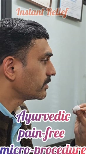 Viddha Karma for Rhinitis | Instamt Relief | Ayurvedic micro-procedure