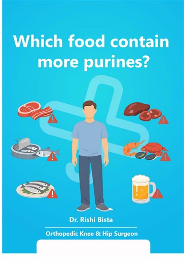 Certain foods are high in purines and can increase uric acid levels, which may trigger gout attacks and joint pain. Common high-purine foods include red meat, organ meats, some seafood, and alcohol. Being aware of these foods helps in better gout prevention and joint health management. Dr. Rishi Bista Orthopedic Knee & Hip Surgeon 🔗 www.drrishibista.com high purine foods, purine rich diet, uric acid, gout, joint pain, dietary management #purine #gout #uricacid #jointhealth #orthopediccare