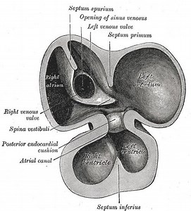 Primary interatrial foramen - Alchetron, the free social encyclopedia
