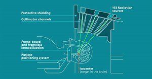 43 reactions · 15 shares | Gamma Knife is the accurate SRS system:...