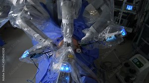 Massive robotic manipulator arms moving over the patient at laparoscopic surgery. Da Vinci robot operating the patient’s abdomen. Top view.