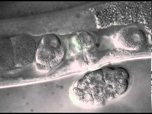 Close up microscope video of a worm laying some eggs