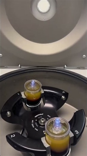 Platelet-Rich Plasma (PRP) Therapy #orthopediccare #plateletrichplasma #prp #orthopedics #ortho