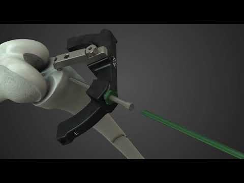 Tibial Nail Surgical Technique