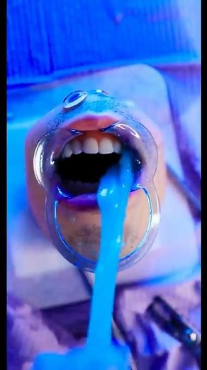 Is Mr Kiwi Ok?? 😱 (he ate slime)💀