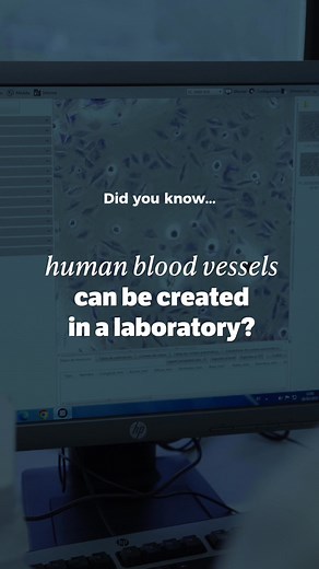 Design life. Heal the body. Build the future. Bioengineering is where innovation meets purpose — and careers take off. Don’t just study science. Shape what’s next. Start your journey with the Bioengineering degree at UIC Barcelona. | UIC Barcelona