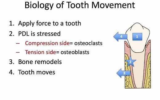 正畸生物力学2牙移动