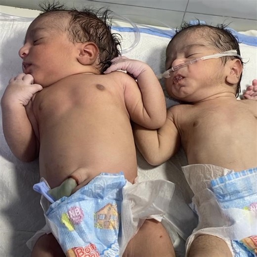 These adorable twin babies — one boy and one girl — are under careful observation in our NICU. They are stable and receiving special care to ensure they stay healthy and strong. 💕👶👧 #NICU​ #Twins​ #CuteBabies​ #NewbornCare​ #TwinLove​ #BabyBoy​ #BabyGirl​ #DoctorAsifKamal​ #Neonatology​ #PrematureBaby​ #TwinBabies | Boom Boom Studio Babies
