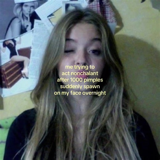 Coping with Sudden Acne Breakouts