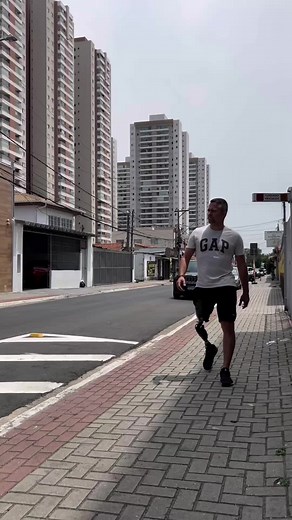 Diogo recebe nova prótese biónica para marcha natural