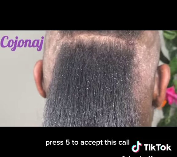 Dandruff Removal Storytime: A Billionaire's Jail Experience