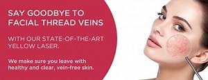 Making Facial Thread Veins a thing of the past - Good Skin Days