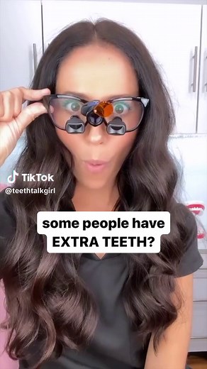 Adults typically have 32 permanent teeth and kids typically have 20 primary teeth. But sometimes nature goes haywire and we can wind up with more teeth than the norm! #teeth #dentalhygienist #dentistry