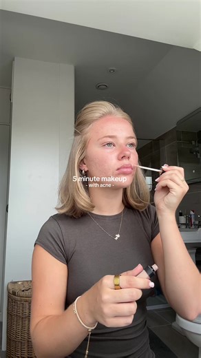 Makeup Tips for Covering Acne in 5 Minutes