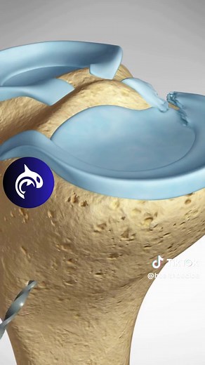 Meniscus Root Repair Surgery: Understanding the Procedure