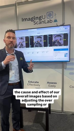Matthew Hayes, President of ScanLab walks us through the newly released Phase Aliasing/Wrap Feature that was released at ECR in Vienna, Austria! #mrisimulation #mrisimulator #mri #scanlabmr