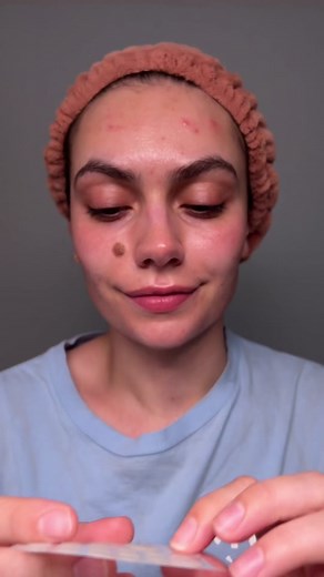 When I posted this on insta people were up in arms over tbe fact that I expected the patch to pull gunk out. I am aware that the patches main function isn’t necessarily to draw gunk out, BUT when I use patches they almost always do. So that is why i expected it. #pimplepatchremoval #pimplepatch #skincaretips #acneskin