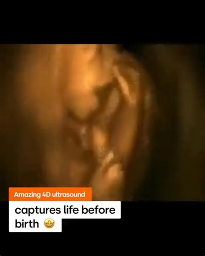 115K views · 9.3K reactions | Human being, not clump of cells. | LifeNews.com | Facebook