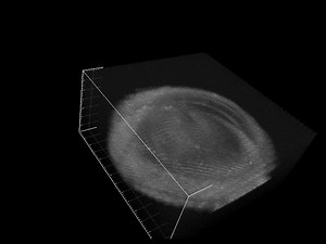 An Alternative and Validated Injection Method for Accessing the Subretinal Space via a Transcleral Posterior Approach