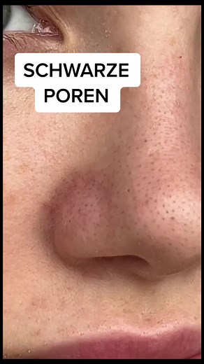 Porenreinigung: 3 wichtige Schritte für schöne Haut