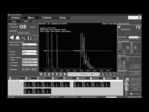 Performing Contact Biometry with the Ellex Eye Cubed