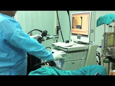 OliveOil lubrication in Colonoscopy