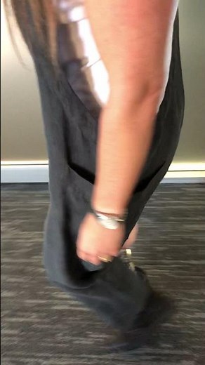 Below knee amputation with osseointegration