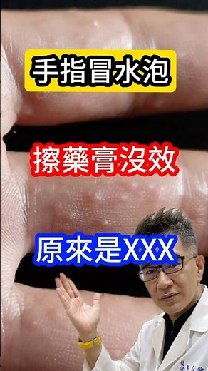 手指冒水泡🫧擦藥都沒效‼️#皮膚科醫生 告訴你原來是XXX#吳仁欽皮膚科診所 #屏東醫美 #汗疱疹 #皰疹 #病毒 #黴菌 #香港腳 #灰指甲 #疥瘡 #手部濕疹 #富貴手 #發炎 #類固醇