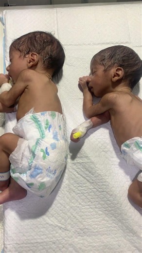 NICU baby #shortvideo #baby #neonatologist #cute #cutebaby