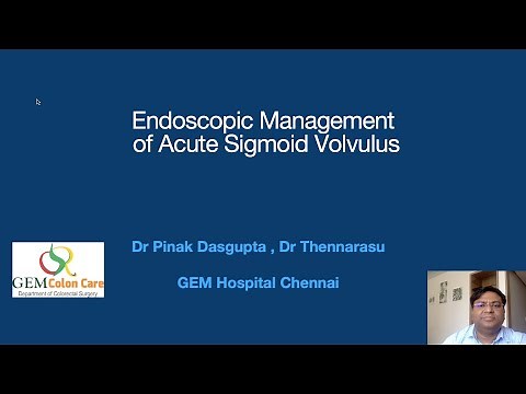 ENDOSCOPIC MANAGEMENT OF SIGMOID VOLVULUS