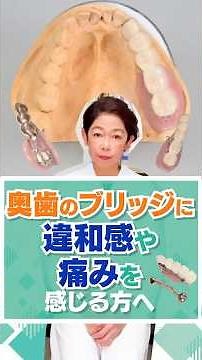 For those who feel discomfort or pain from bridges on their molars