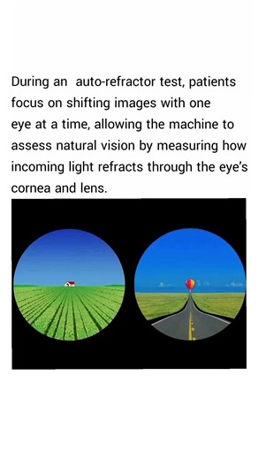 the scenes typically viewed during an eye exam using an auto- refractor