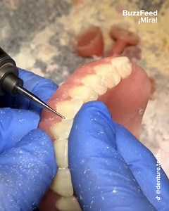 Sigue a "denture.tech" aqui: https://www.tiktok.com/@denture.tech | Pero Like