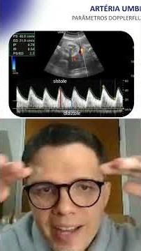 How to perform Doppler ultrasound of the umbilical artery | Obstetric ultrasound
