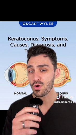 Keratoglobus is an extremely rare condition that can easily go misdiagnosed in the early stages if the proper testing isn’t done. Thank you to @valerie 🖤 for letting me stitch her video. She mentioned that it took 6 different doctors and almost 10 years before she was properly diagnosed and managed 🤯 #greenscreen #greenscreenvideo #keratoconus #cornea #eyehealth #eyes #eyetips #optometrist #dryeyespecialist #eyedoctor #doctorsoftiktok #doctor #stitch #cool #torontolife #torontotiktok #sclerale