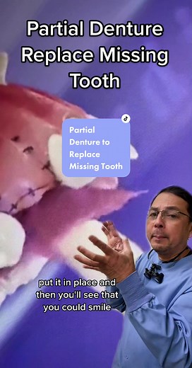 #greenscreenvideo if you have to pull out a front tooth, you DO NOT have to go home empty handed. Before extracting that tooth, make sure to coordinate with your dental provider and prepare for a partial denture #partialdenture #toothextraction #missingteeth #missingtooth #teethextraction #dentist #dental #dentistryworld #dentistry #dentalcare #dentalprocedure #dentaleducation #foryou