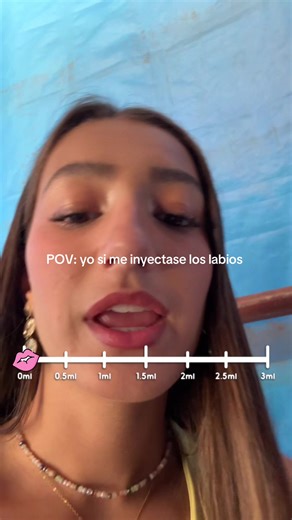 Inyección de Labios: Mi Experiencia Literal