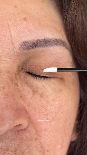 1.8M views · 2K reactions | Immediate tightening can be seen...