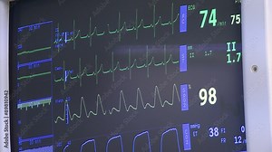 surgery in an operating room/permanent monitoring of vital function