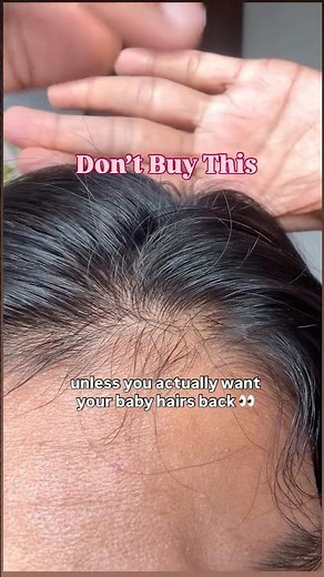 Does this Hair Growth Roll-On really work? 👀 Be Bodywise Honest Review! #bebodywise #picksbyvidhu