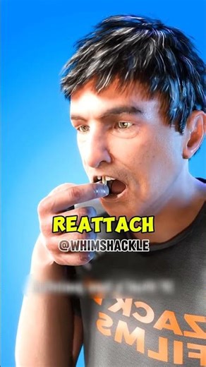 Knocked Out Tooth? DO THIS FAST 🦷‼️😱