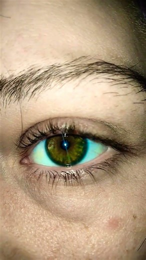 never know what colour my eye will be #heterochromia #random #uniqueeyes #imtrying #onlyhaydez