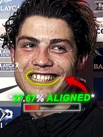 Ronaldo Teeth Alignment Through the Years 🥶🤯