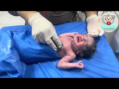Newborn First Assessment | Healthy Moro Reflex | Baby Care with Dr Shahzad