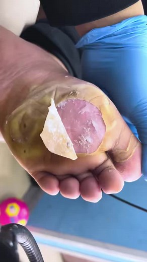 121K views · 861 reactions | You won’t believe what came out of this...