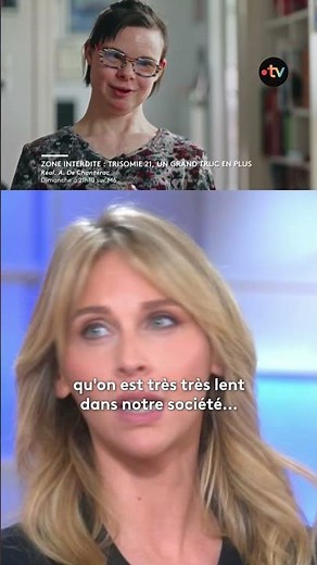 Trisomie 21 : encore loin de l'inclusion