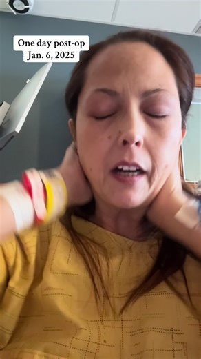 Hip Replacement Recovery: One Day Post-Op