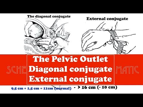 The Pelvic Outlet, Diagonal conjugate and External conjugate